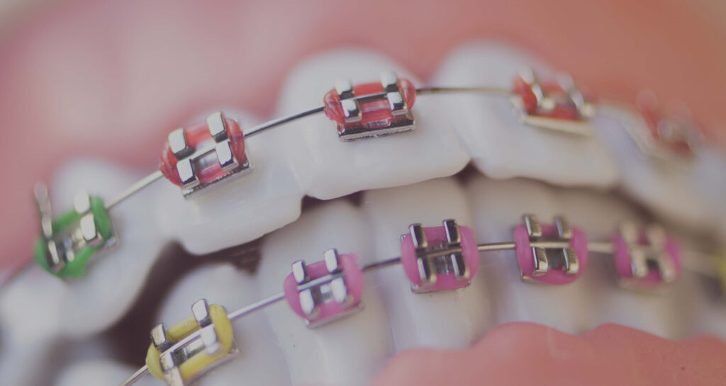 Assure Orthodontics Courses